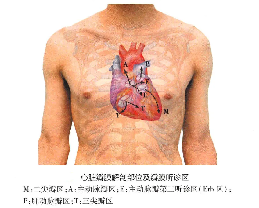 心脏瓣膜解剖部位及瓣膜听诊区示意图